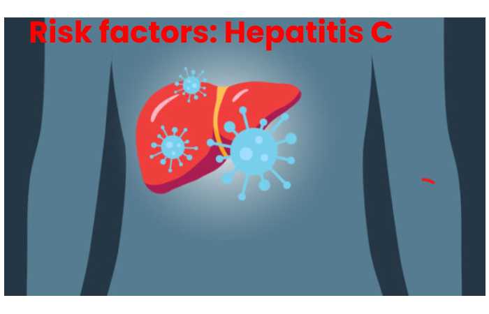 Risk factors: Hepatitis C