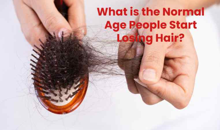 What is the Normal Age People Start Losing Hair?