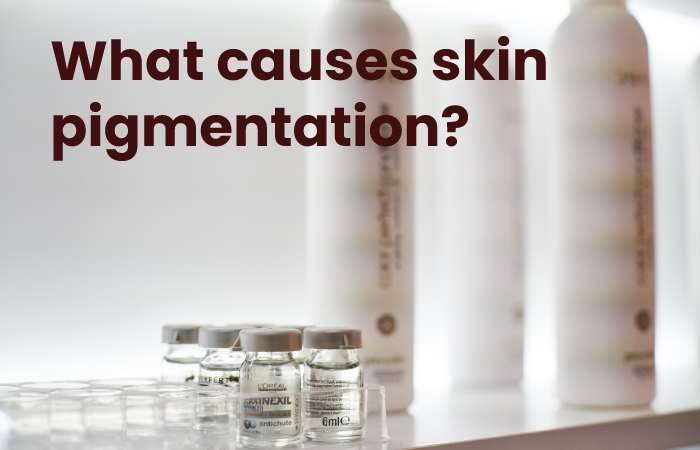 What causes skin pigmentation?