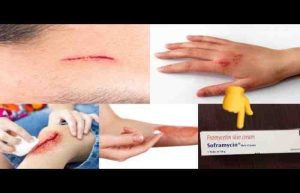 Framycetin Skin Cream - Uses, Price, Benefits