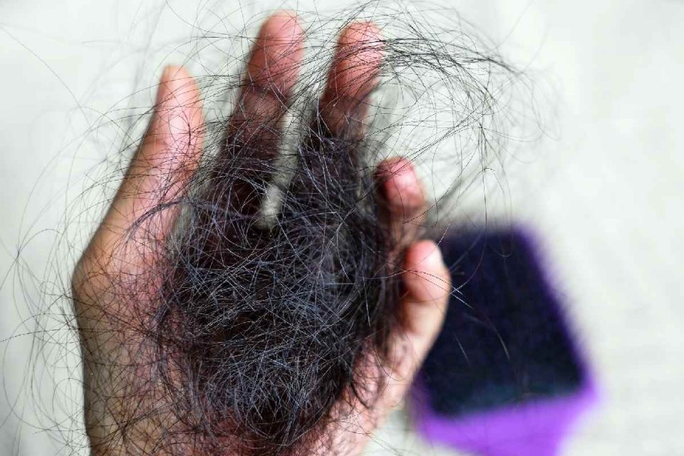 Hair Loss - Hair Loss Once You Reach 30
