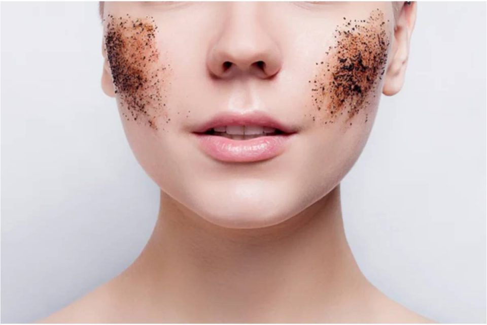 Hyperpigmentation