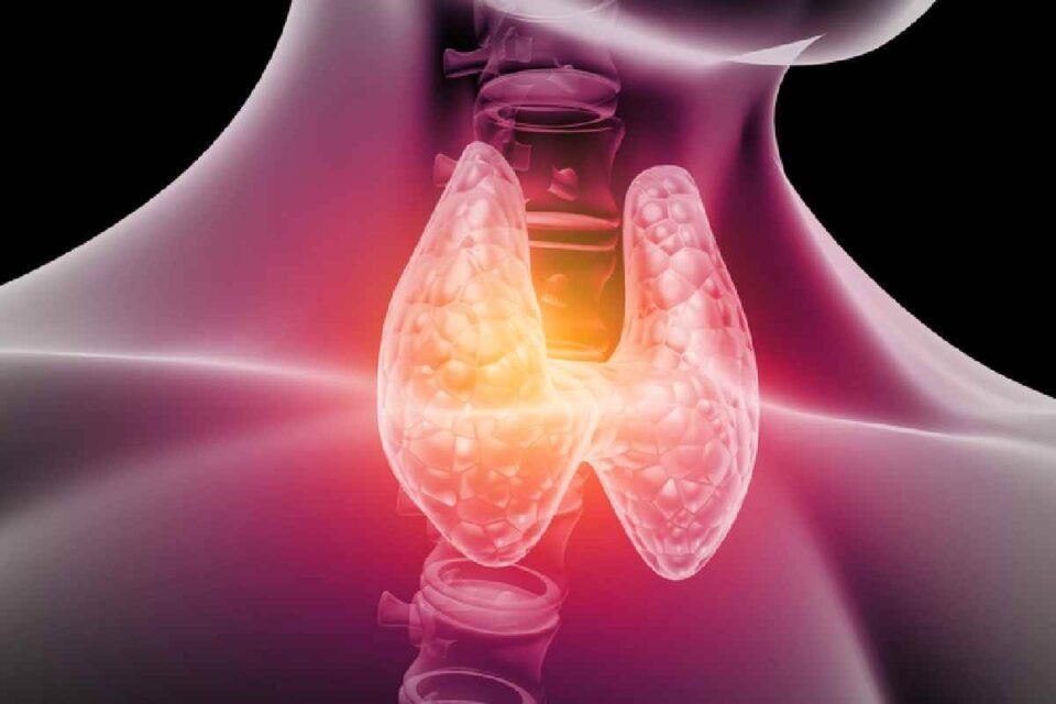 Hyperthyroidism
