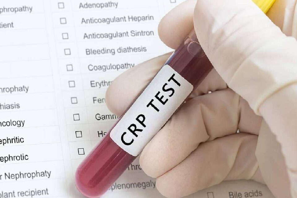 CRP