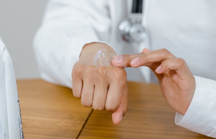 Close-up of a doctor applying lotion on their hand, focusing on skincare.